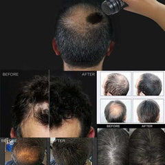 White Private Label Keratin Fibrils 98% & 2% Biotin Powder 50g and Fiber Holding Spray 120ml Pack