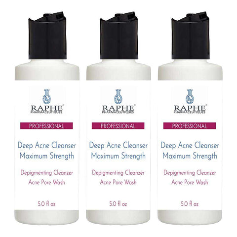 Wholesale Maximum Strength Deep Acne Cleanser & Pigment Removal Wash 300 of the 5oz