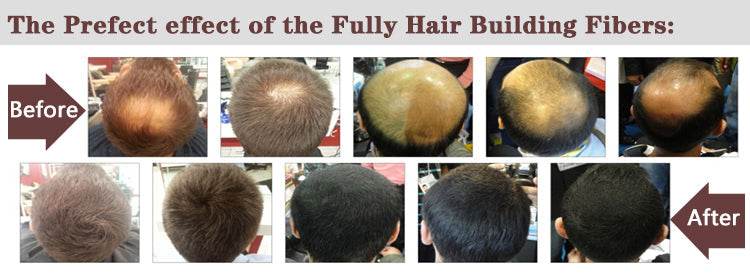 White Private Label Keratin Fibrils 98% & 2% Biotin Powder 50g and Fiber Holding Spray 120ml Pack