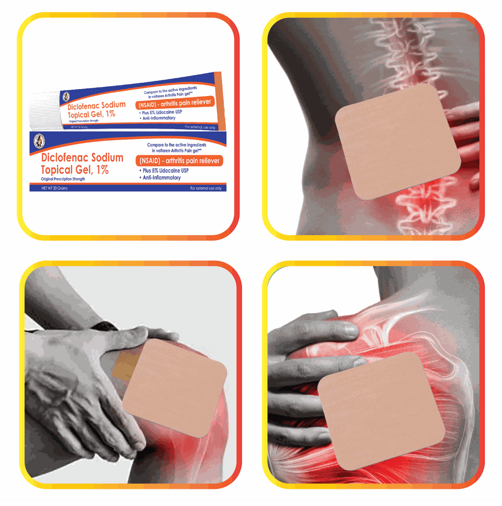 Sodium Diclofenac 2% and 5% Lidocaine External Analgesic Trandermal Patches