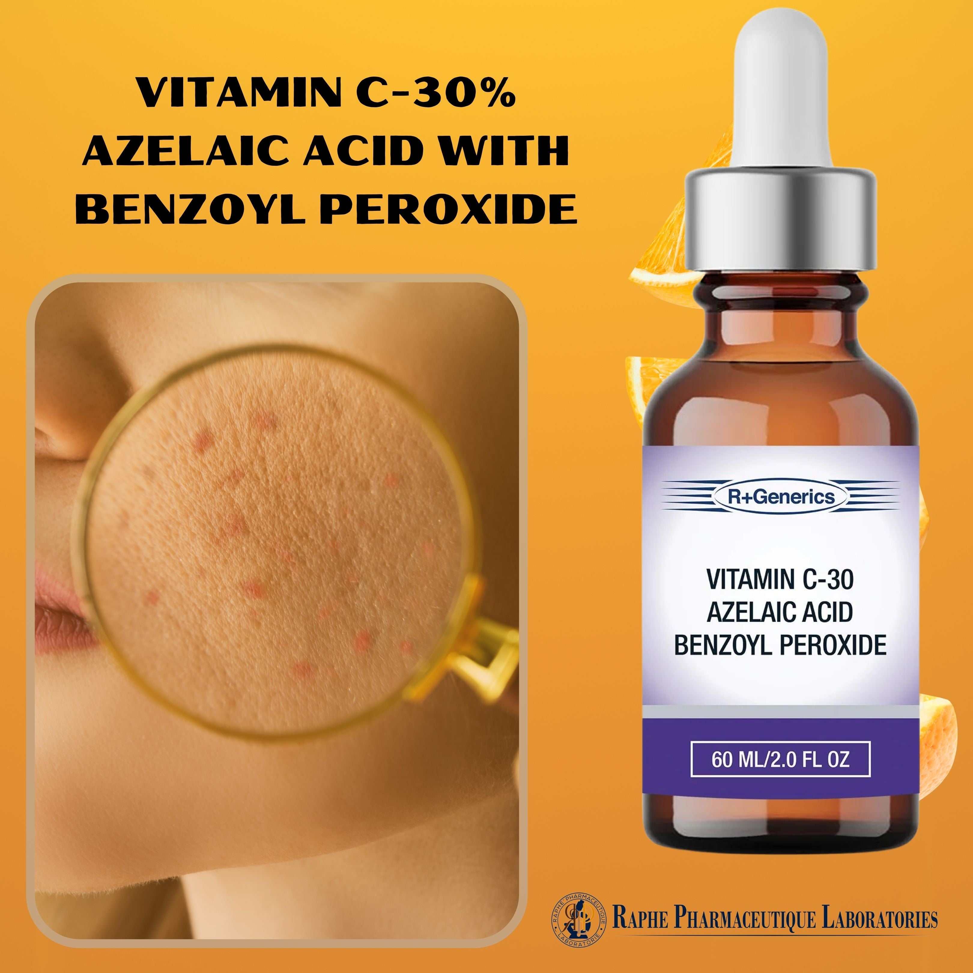 Vitamin C-30% Azelaic Acid with Benzoyl Peroxide Wholesale 15,000