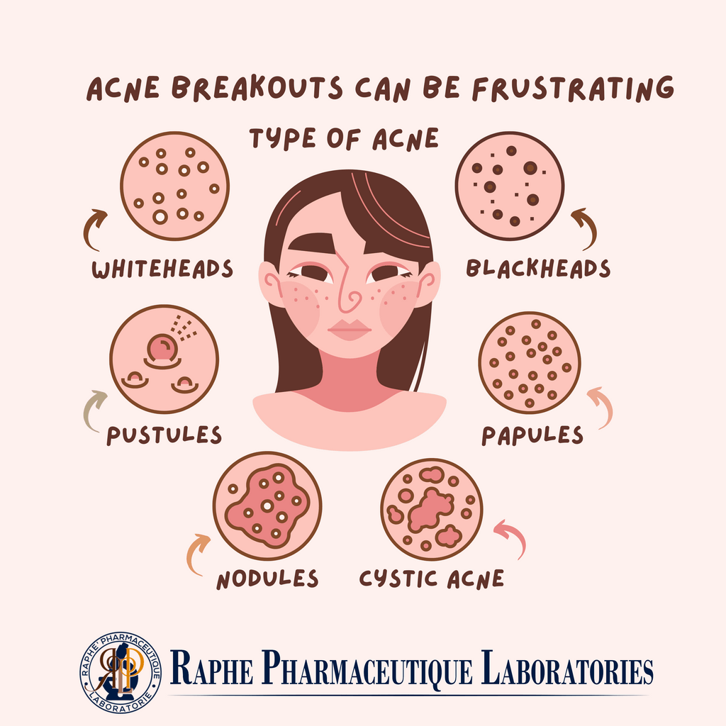 Tretinoin 0.05% Adapalene 0.03% and Salicylic acid 2% Acne Relief Gel