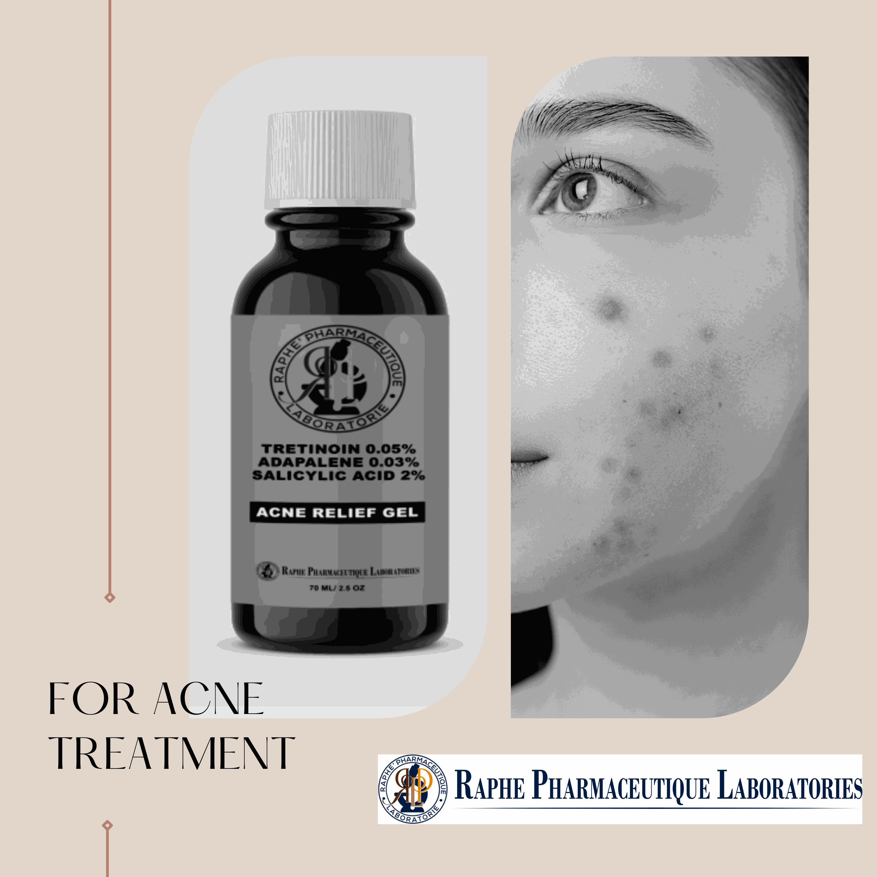 Tretinoin 0.05% Adapalene 0.03% and Salicylic acid 2% Acne Relief Gel